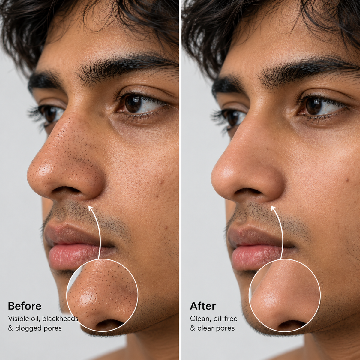 EVEEMA NOSE PATCHES FOR MEN