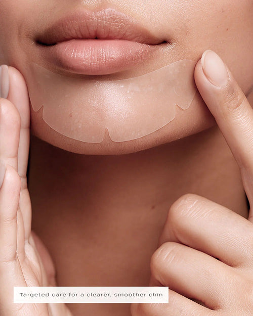 CHIN PATCHES